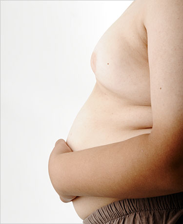 Niño con sobrepeso